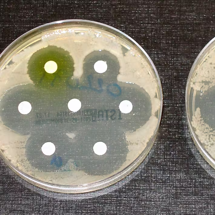 Petri dishes showing antibiotic resistance tests